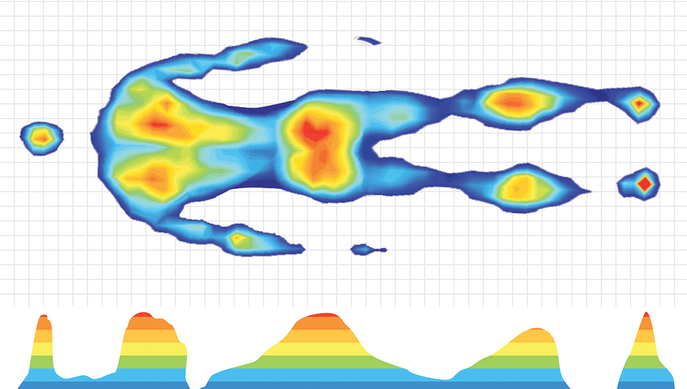 Thermal imaging showing peak pressure areas | Support Report